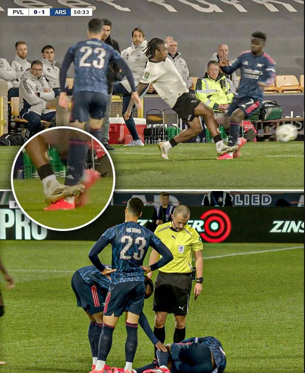 冲刺阶段突围战来临，布莱顿围绕足总杯门线救险，态度坚定，球探报告显示潜力的简单介绍